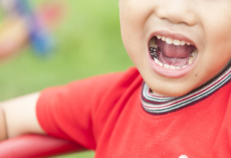 6 beneficios de las coronas dentales para niños