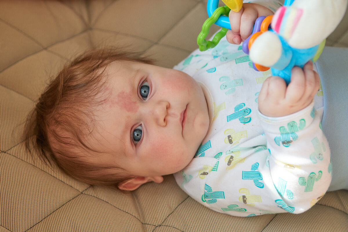 Un bébé avec une tache au milieu des yeux.