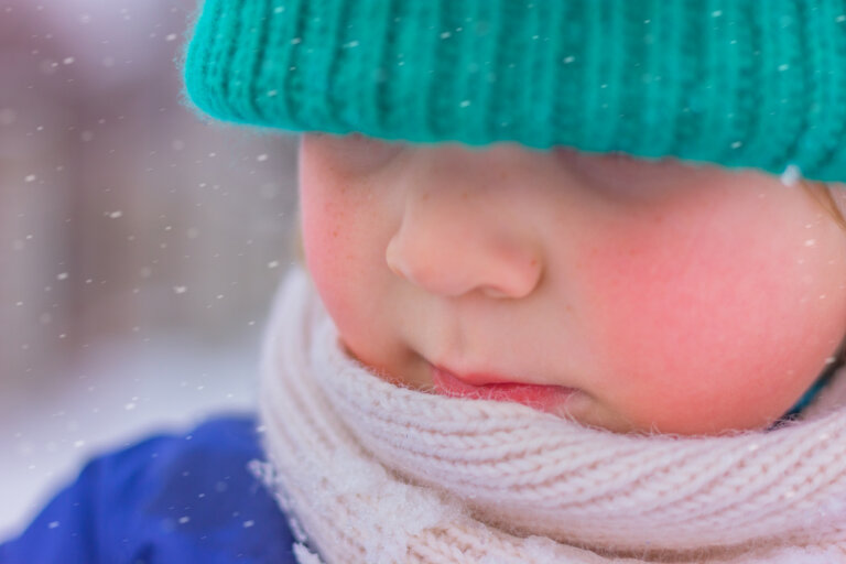 Cómo cuidar la piel atópica del bebé cuando hace frío