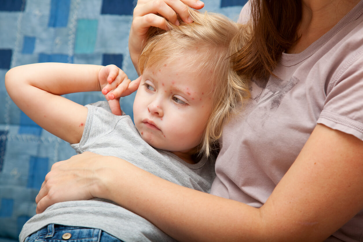 A child with red spots on her skin lying in her mother's arms.