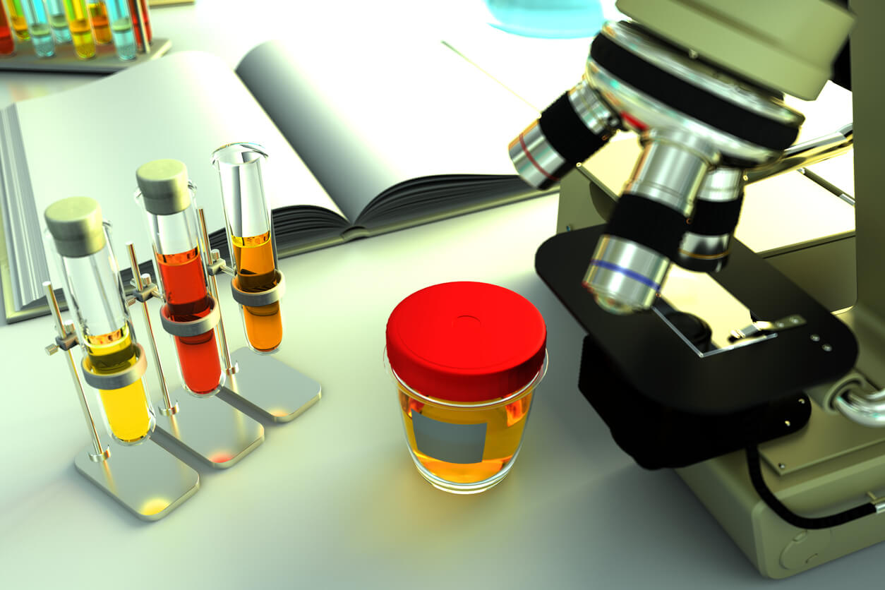 A microscope examining urine samples.