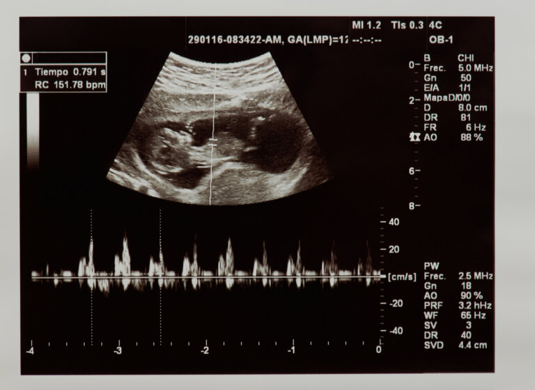 Así son los latidos de un feto en el vientre de su madre
