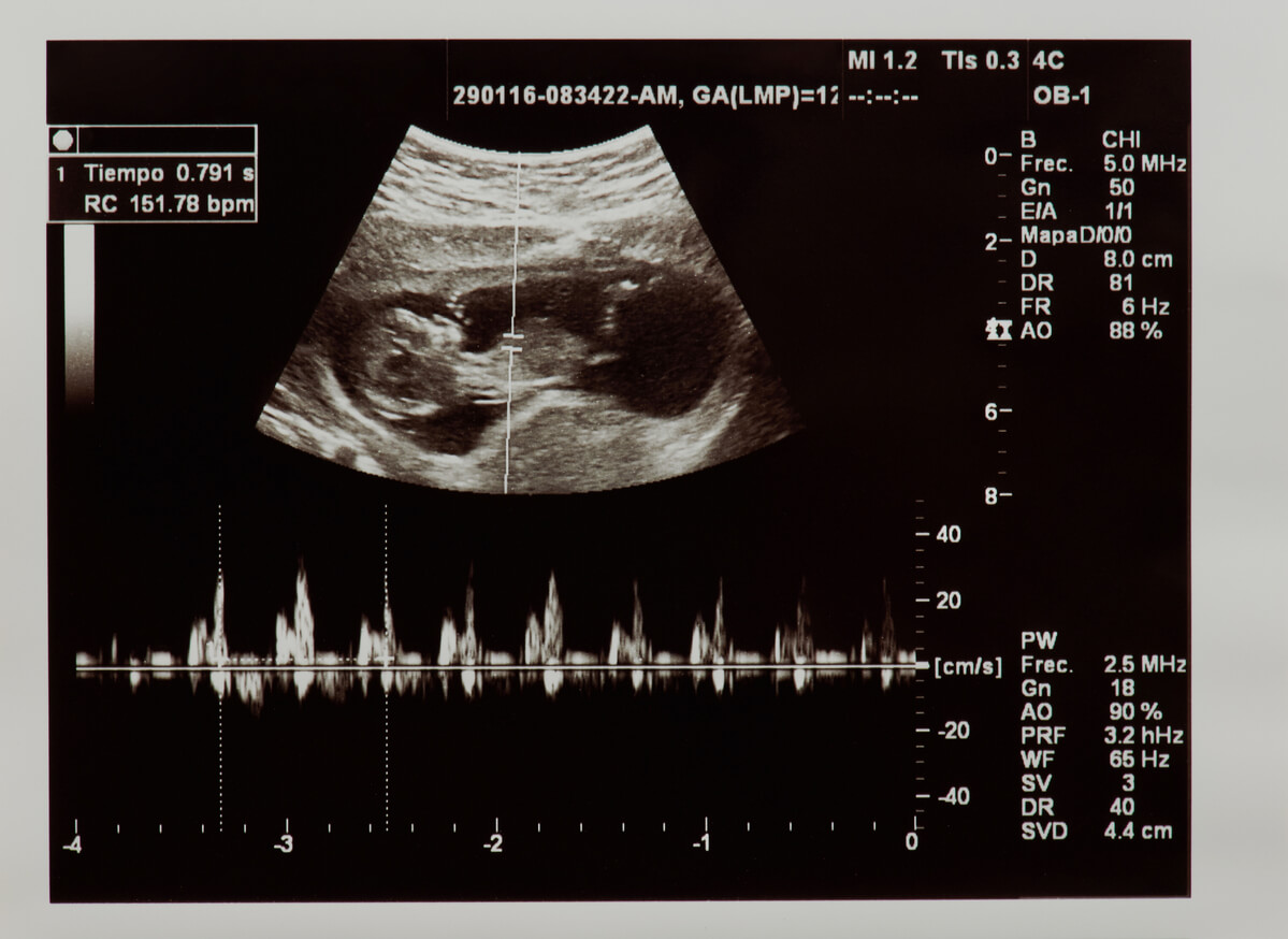 Así son los latidos de un feto en el vientre de su madre - Eres Mamá