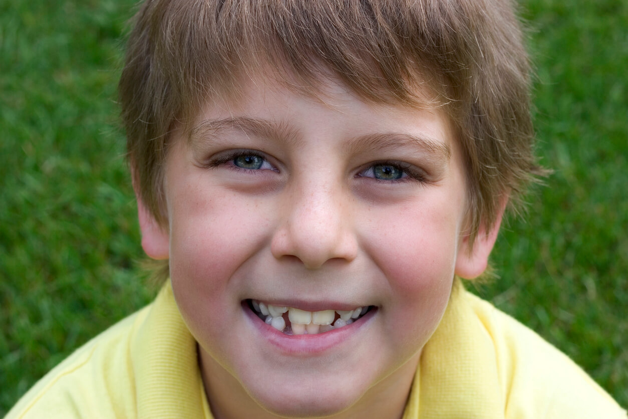 Los nuevos dientes de mi hijo son amarillos, ¿es normal?