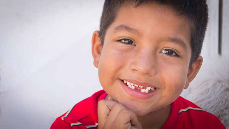 Agenesia dental en niños: lo que debes saber