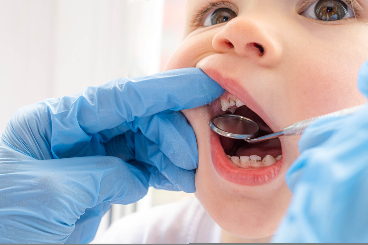 En tannlege ser på en pjokk hvis tenner er fulle av hull.