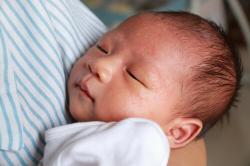 Alergia a la leche en bebés: lo que debes saber