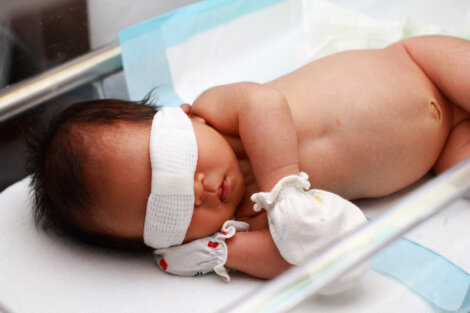 Bilirrubina alta en bebés: lo que debes saber
