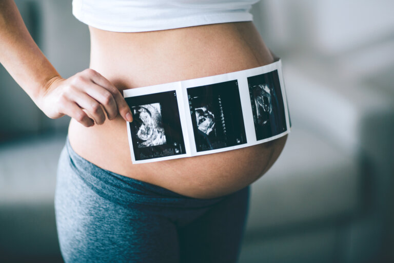10 dudas sobre las ecografías en el embarazo