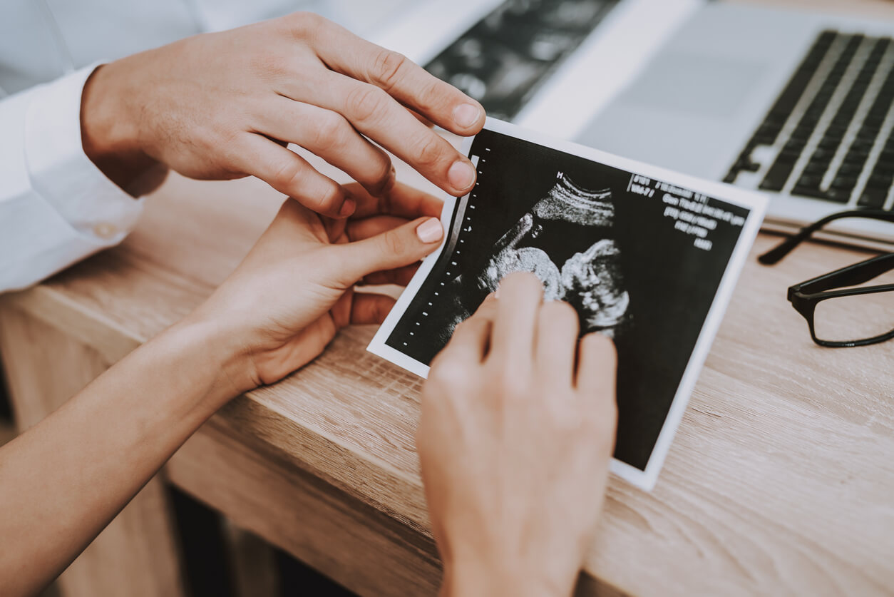 Photo d'une échographie de grossesse dans les mains de la femme.