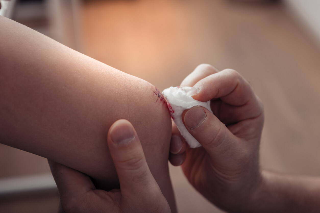 Absceso en los niños: síntomas, causas y tratamientos