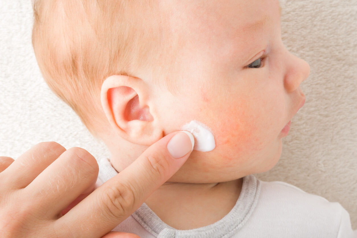 Een verzachtende crème voor de babyhuis