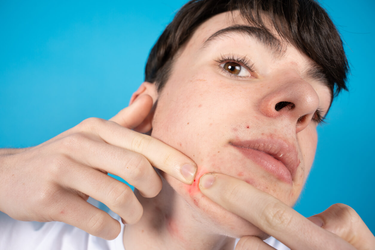A teenage boy trying to pop a pimple.
