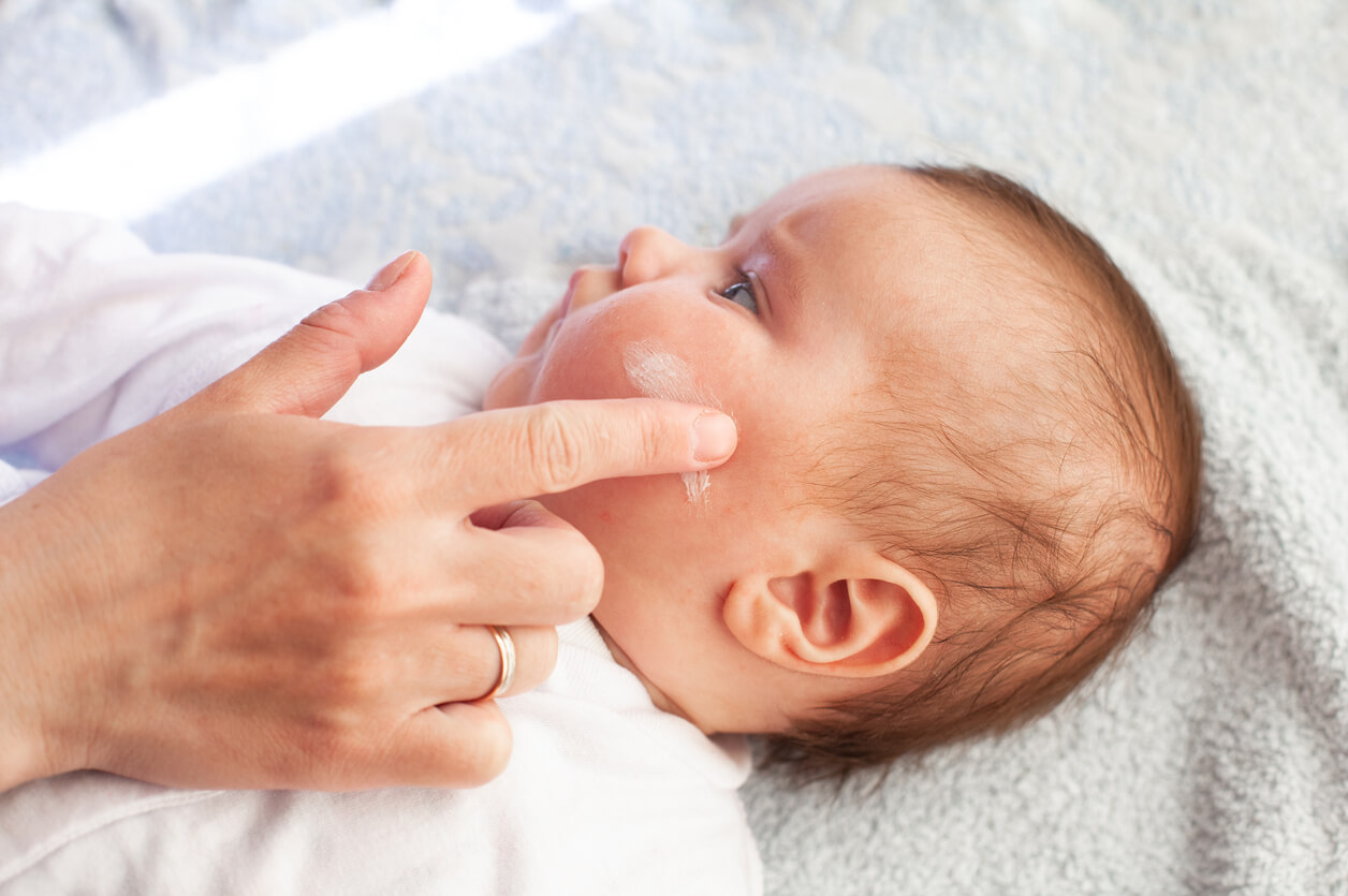 Types of Rashes in Infants and How to Treat Them