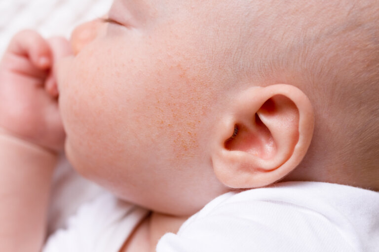 Granos en la cara del bebé: ¿a qué se deben y qué hacer?