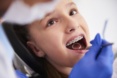 Ortodoncia temprana en niños: ¿expansión o extracciones dentarias?