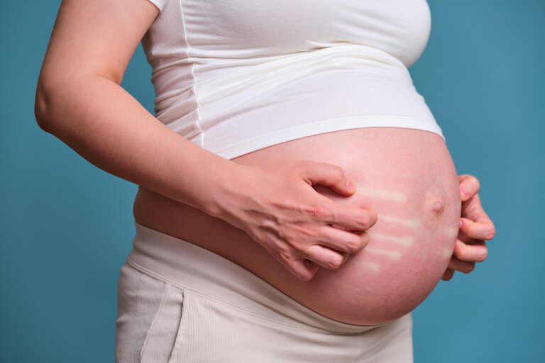 Alergia cutánea durante el embarazo