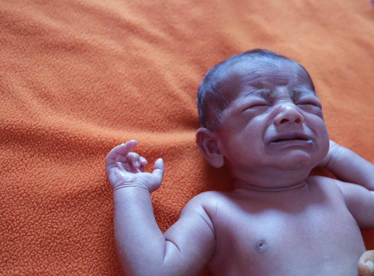 A newborn baby with a bluish skin tone.