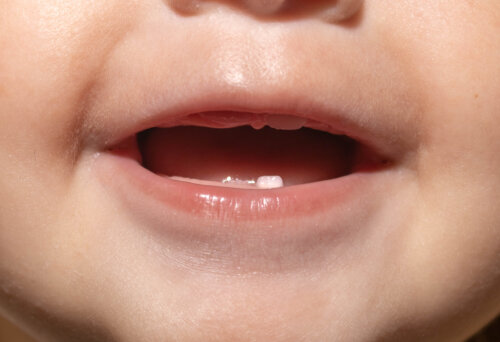 ¿Qué esperar de la primera consulta con el odontopediatra?