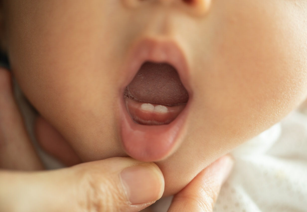 En baby med to bunntenner kommer inn.