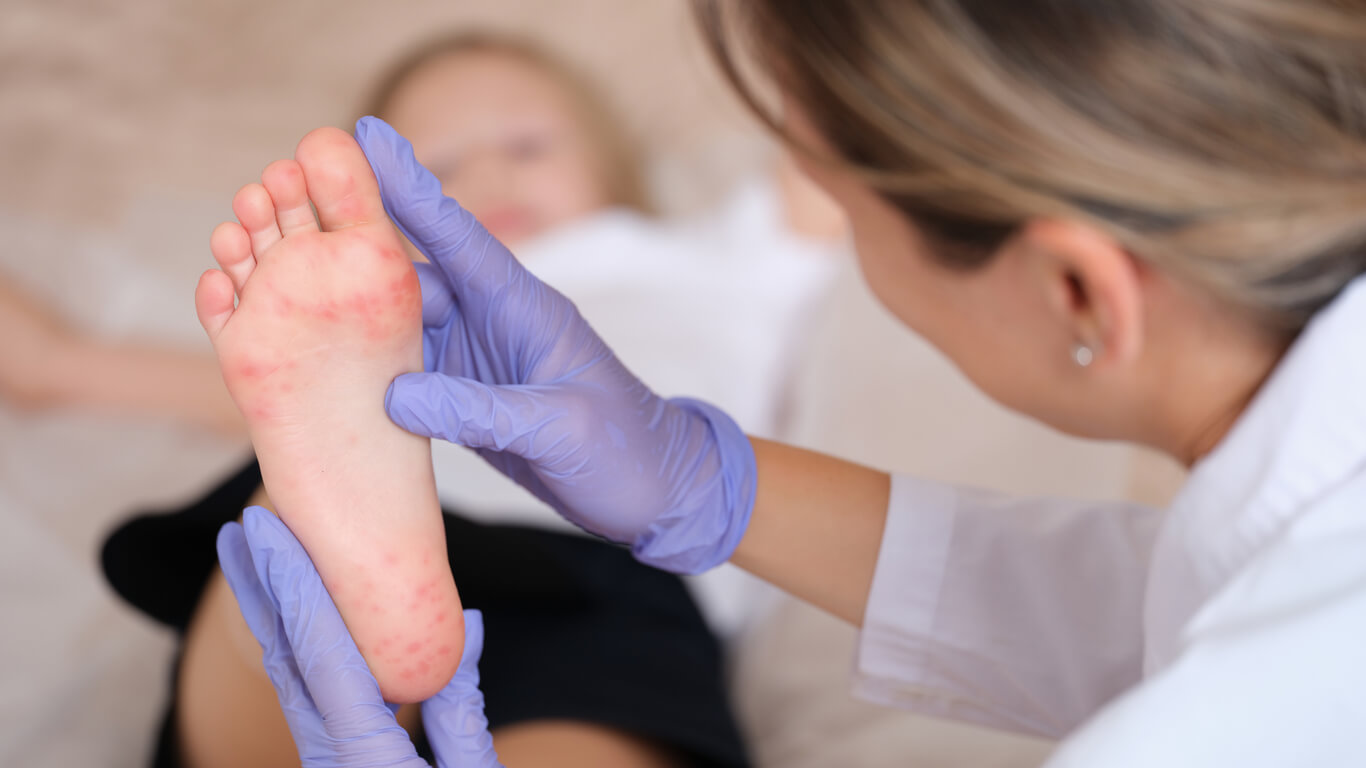 A doctor looking at red spots on the soles of a child's foot.