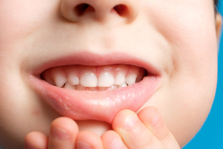 ¿Puede volver a crecer el esmalte en los dientes de los niños?