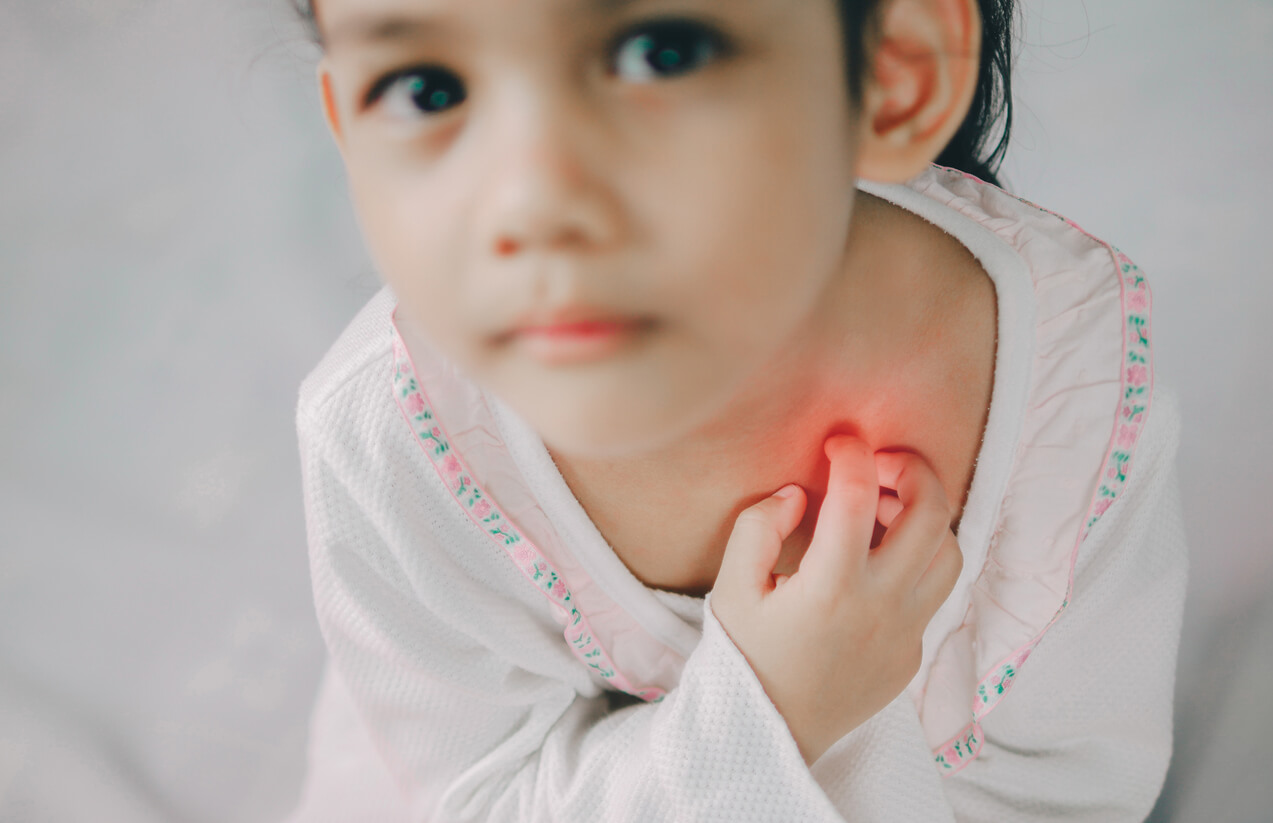 Tiña en bebés y niños: síntomas, causas y tratamiento