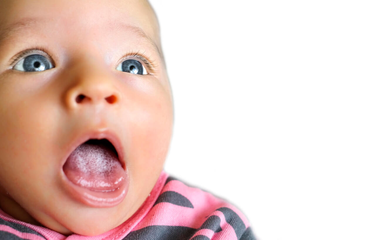 Sapinho Sapinho em bebês: sintomas, causas e tratamento - Sou Mamãe