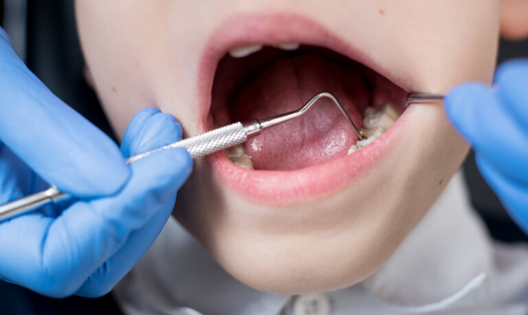 Los 6 tratamientos de odontología más comunes en niños