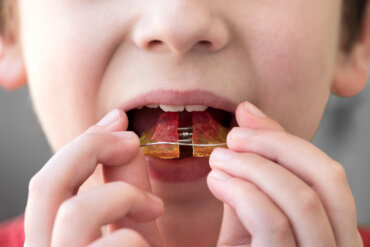 Ortodoncia infantil: ¿A qué edad se puede iniciar?