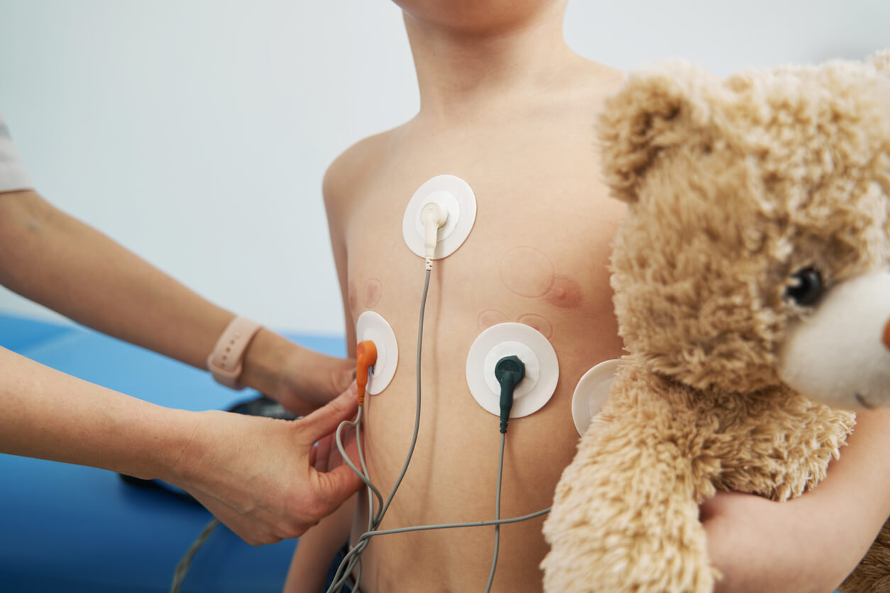Arritmias en niños: lo que debes saber