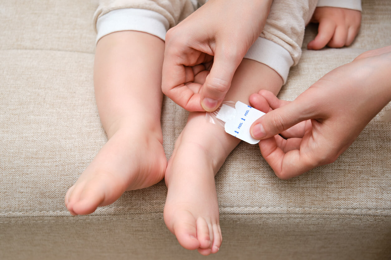 Verrue sur la peau d'un bébé.