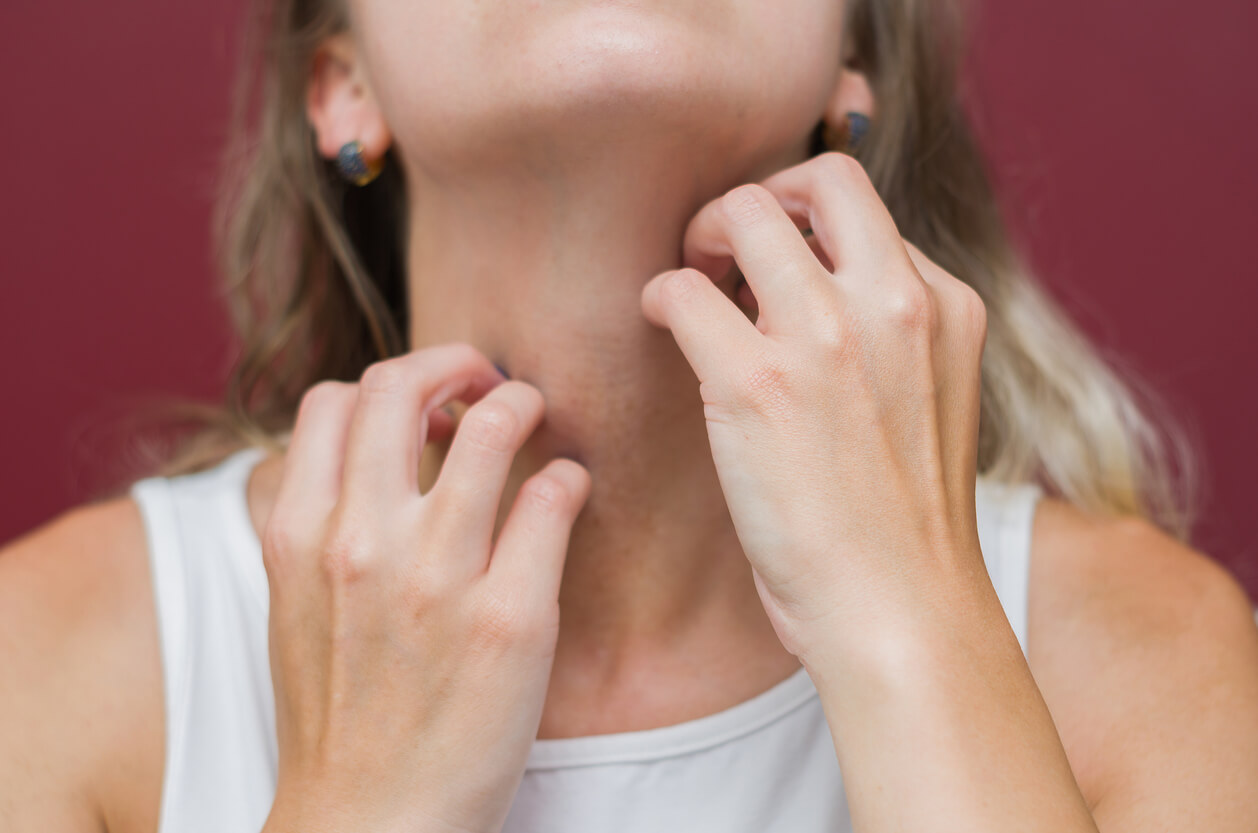 ¿Los padres pueden transmitir la dermatitis atópica a sus hijos?