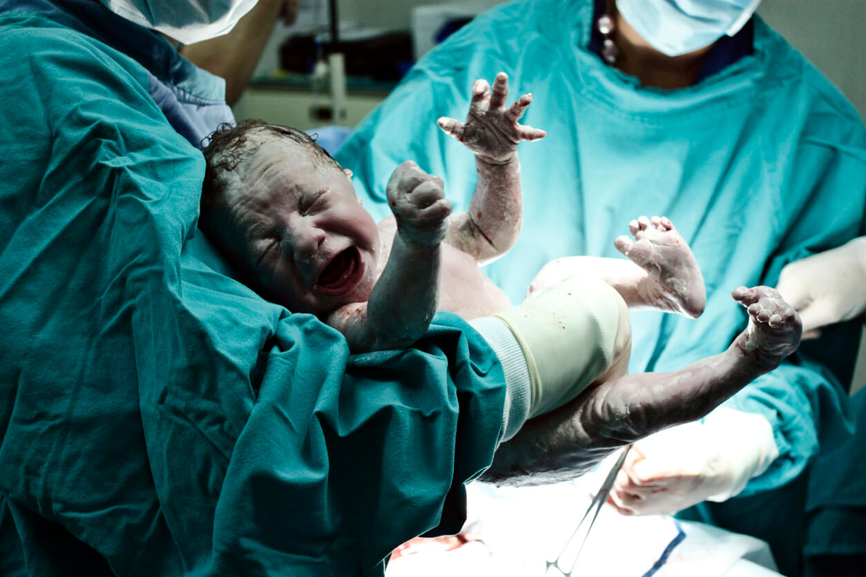 A newborn baby covered in vernix caseosa.