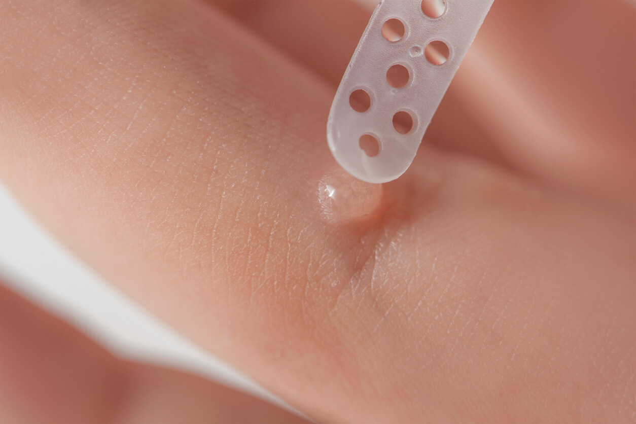 Gel til behandling af vorter hos babyer