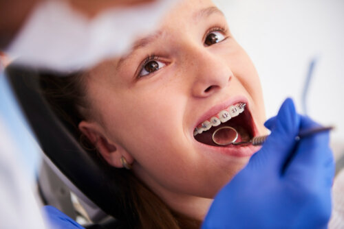 Fases del tratamiento de ortodoncia en niños