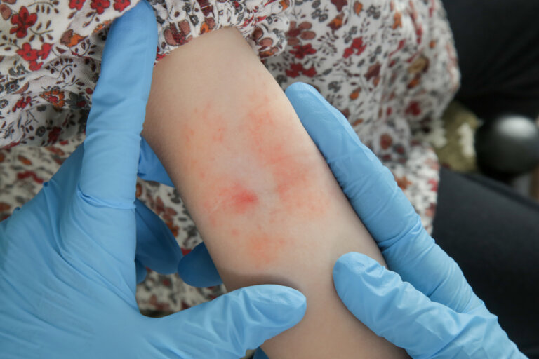 señales necesita probióticos