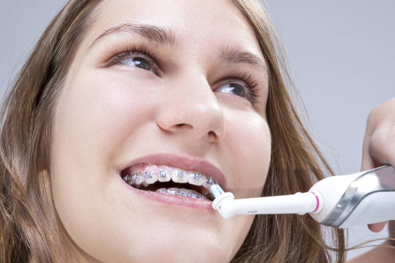 7 consejos de higiene dental para niños con brackets