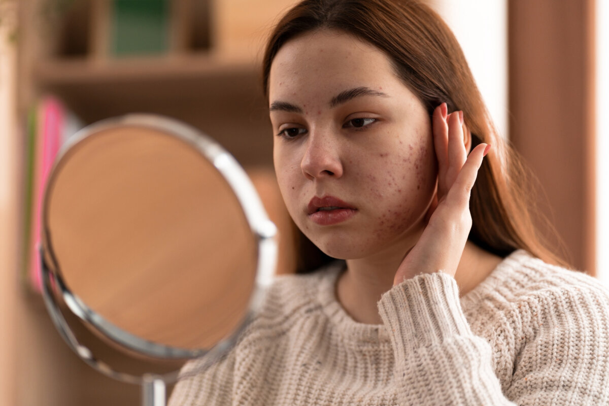 8 consejos para maquillarte si tienes acné