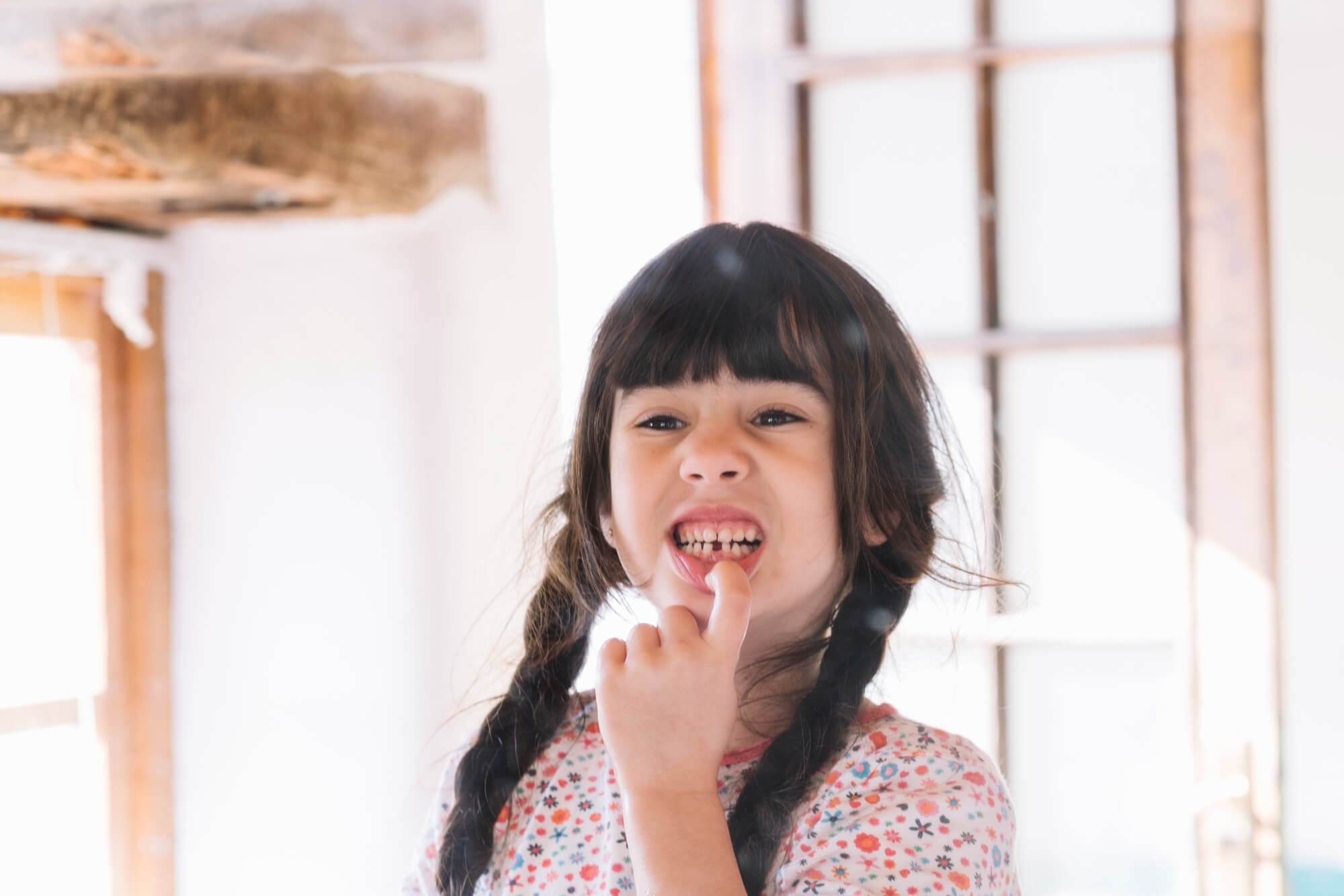 Dientes muy grandes o muy pequeños en niños, ¿es normal?