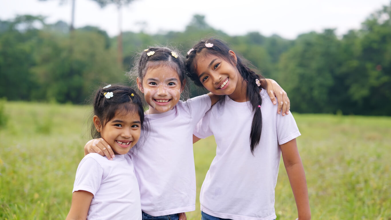 Tipos de alimentos para mejorar el vitiligo en niños