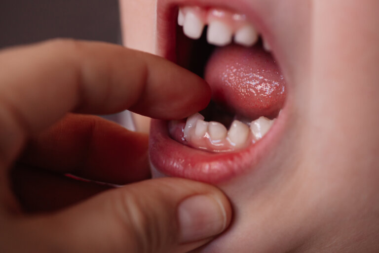 ¿En qué se diferencian los dientes de leche de los permanentes?
