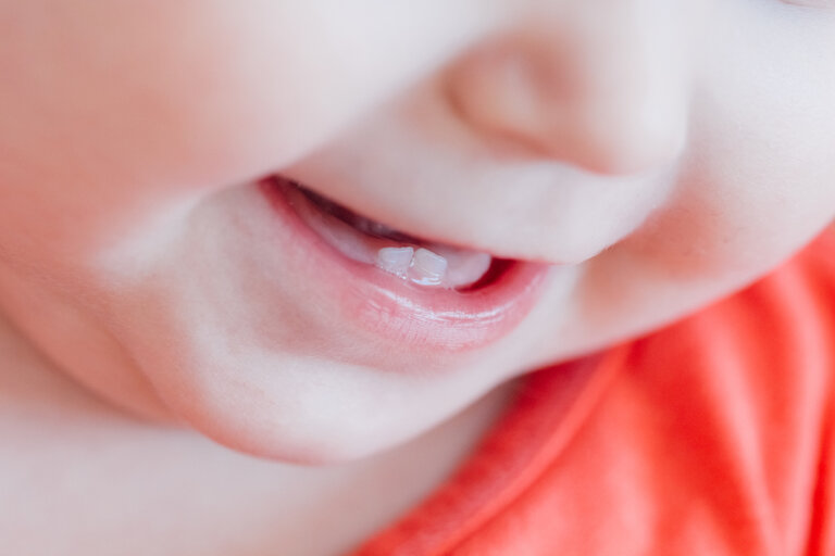 ¿La salida de los dientes del bebé causa dermatitis del pañal?